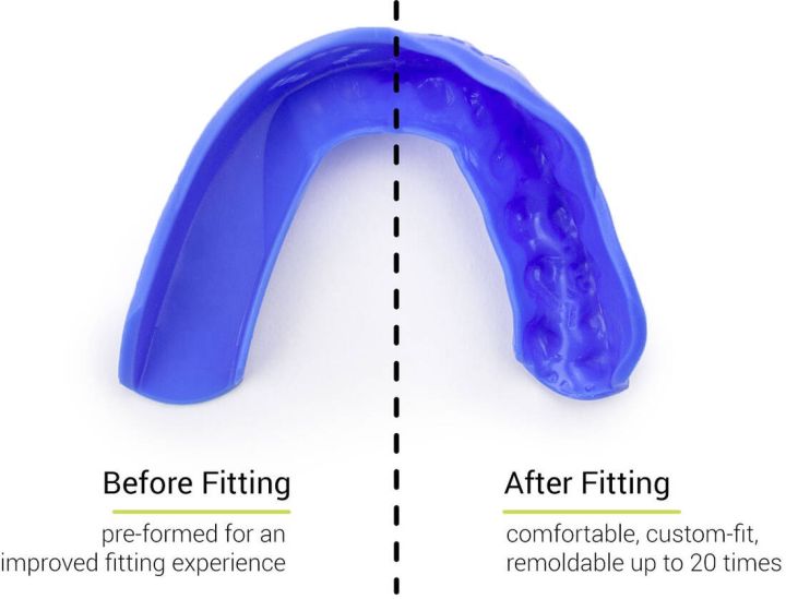 Ščitnik za zobe Sisu 3D Royal Blue